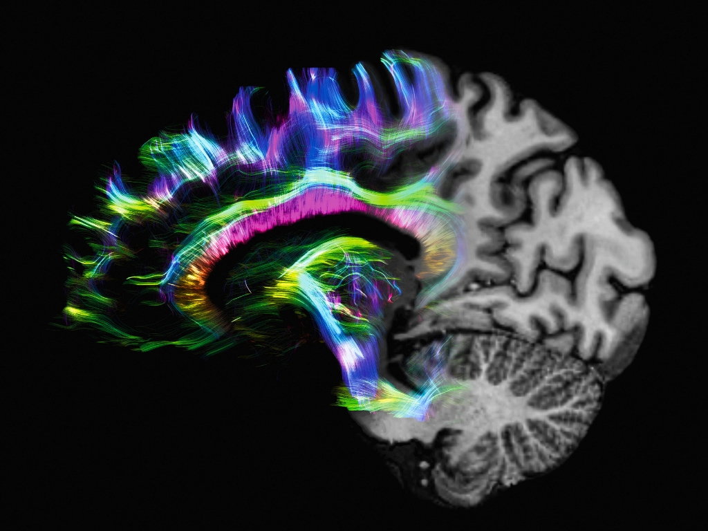 Imagen cerebral