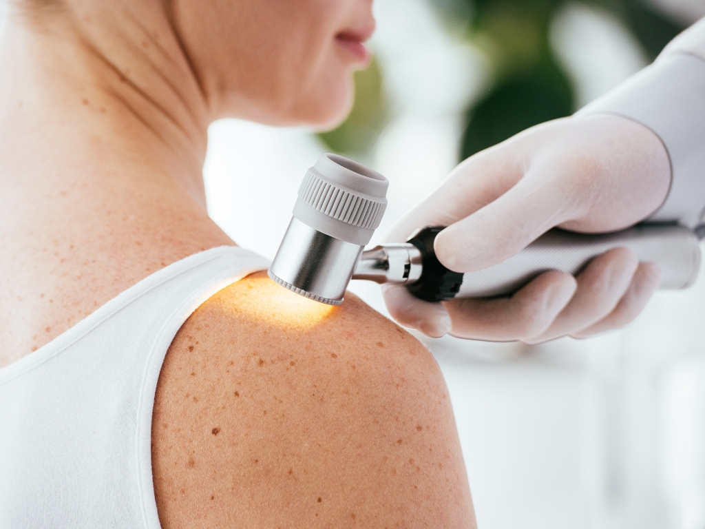 Revisión dermatológica