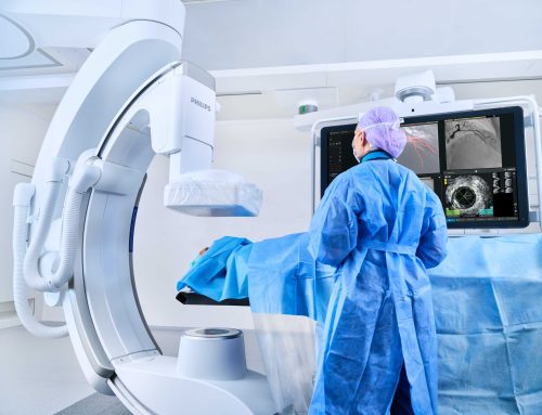 Philips lanza el estudio RADIQAL para generar pruebas reales de la nueva tecnología de dosis ultrabaja de rayos X en procedimientos coronarios